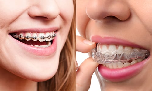 benjamin carrel orthodontie